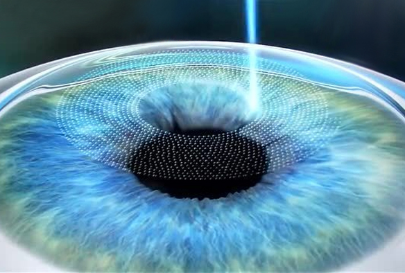 某上市醫(yī)療集團(tuán)眼科醫(yī)院—O2BOX高壓氧艙案例展示-高壓氧艙,O2BOX高壓氧艙官網(wǎng),高壓氧艙多少錢一臺(tái)